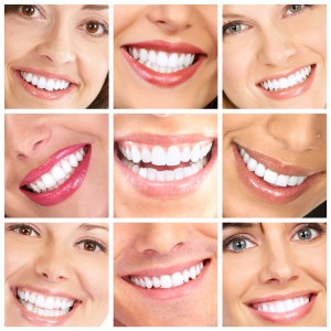 collage of happy, smiling faces with amazingly white teeth