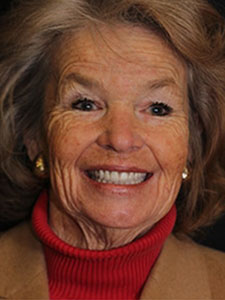 After extraction, we provided her with the Denture Fountain of Youth®.
